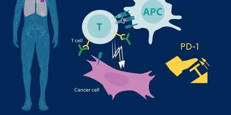 điều trị ung thư